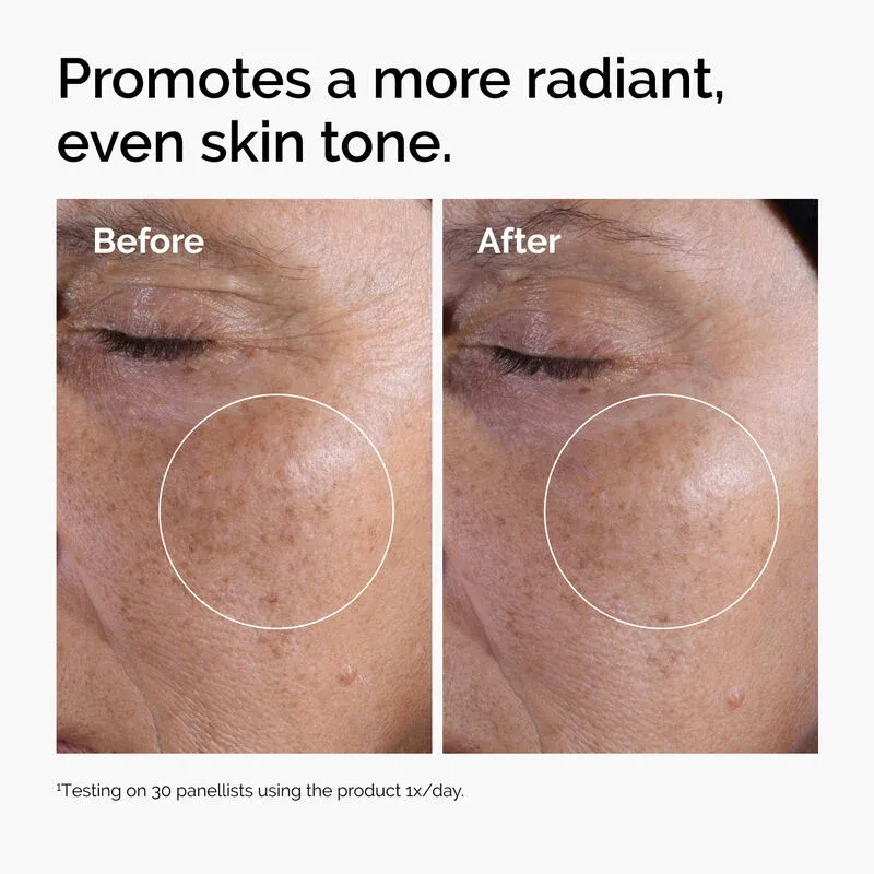 glycolic 2.webp