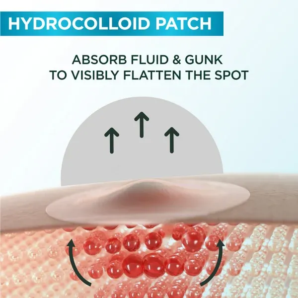 GarnierSkinActiveFastClearInvisiblePimplePatch8HoursHydrocolloid22Patcheshowitworks.webp