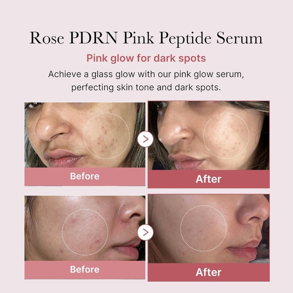 PDRN-Pink-Peptide-Serum-MEDICUBE-4.jpg